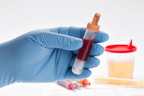 Cord Blood: A Complete Guide to Its Benefits, Uses, and Importance